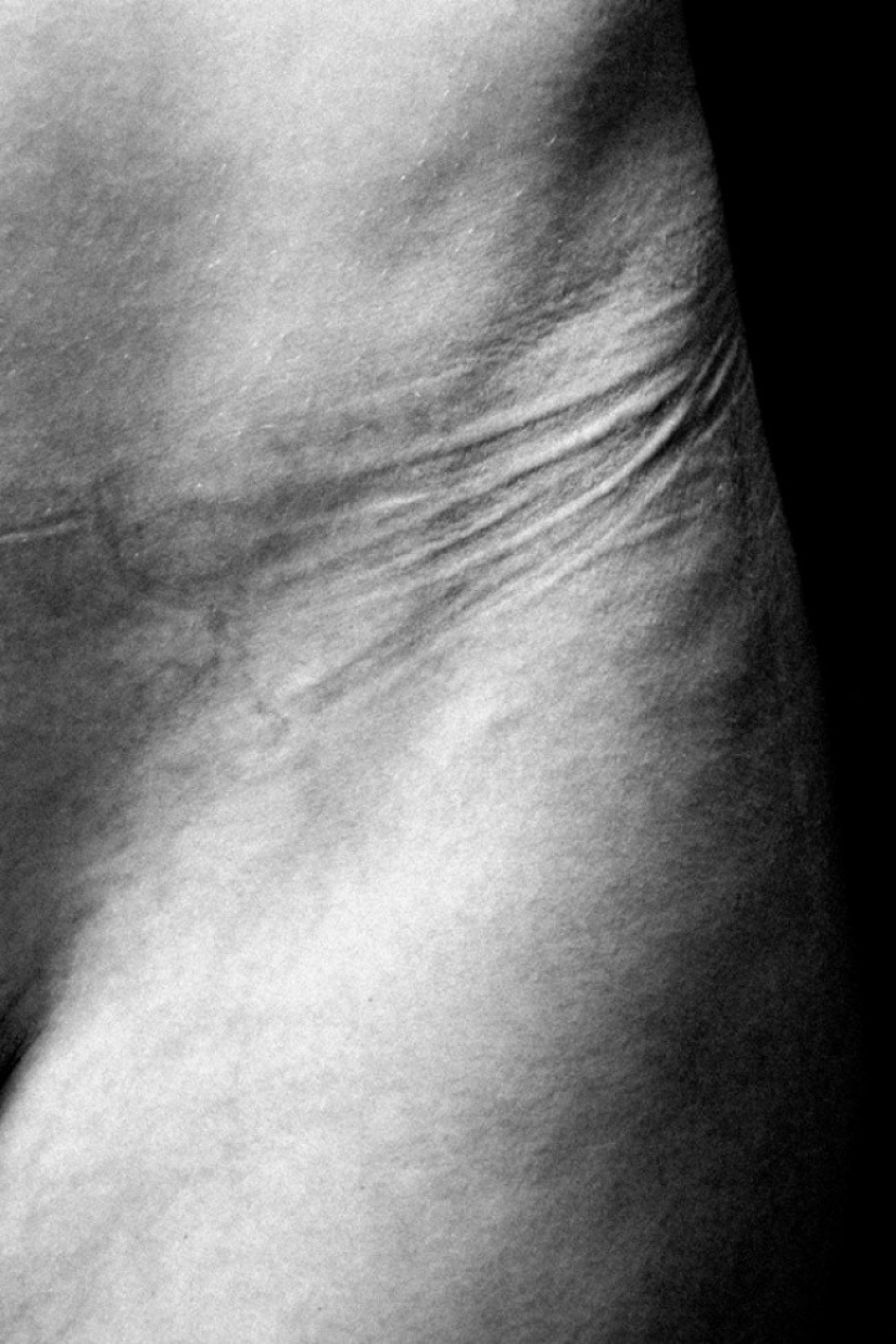 Esto es lo que está detrás de la hembra esplendor. En estas fotos aún es doloroso ver