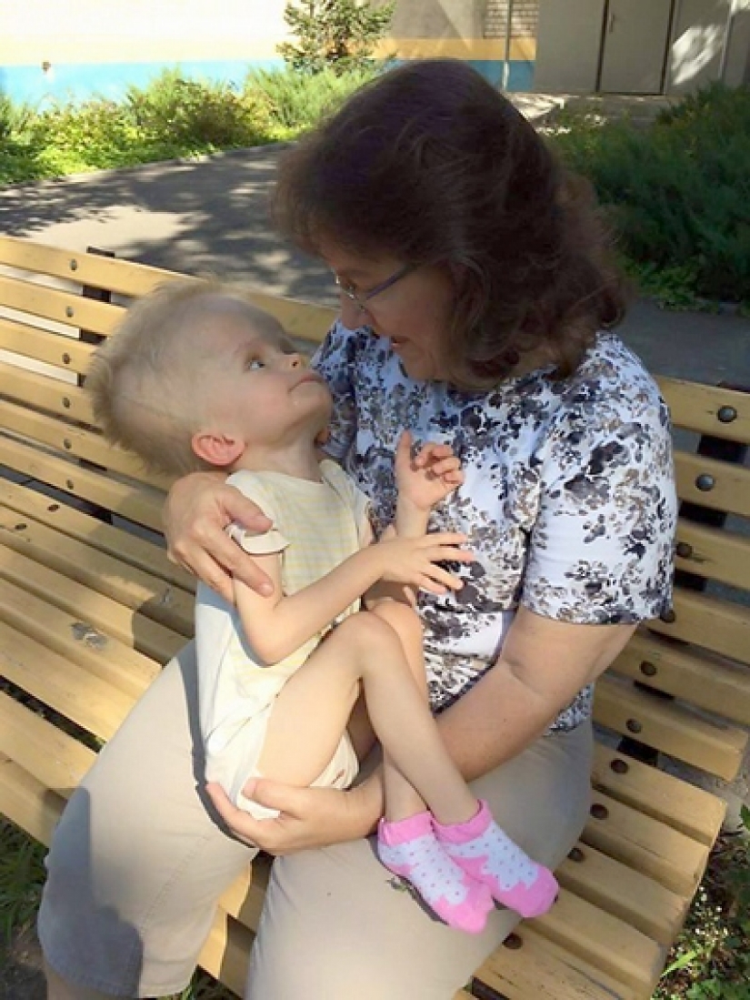 From a boy with an unusual head proved to be parents, but fate gave him a new family From a boy with an unusual head proved to be parents, but fate gave him a new family