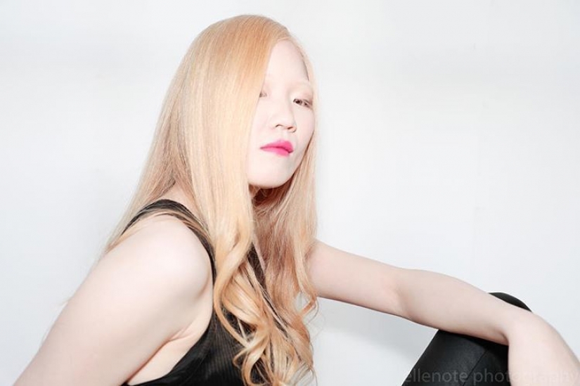 How are albinos different nationalities and races How are albinos different nationalities and races