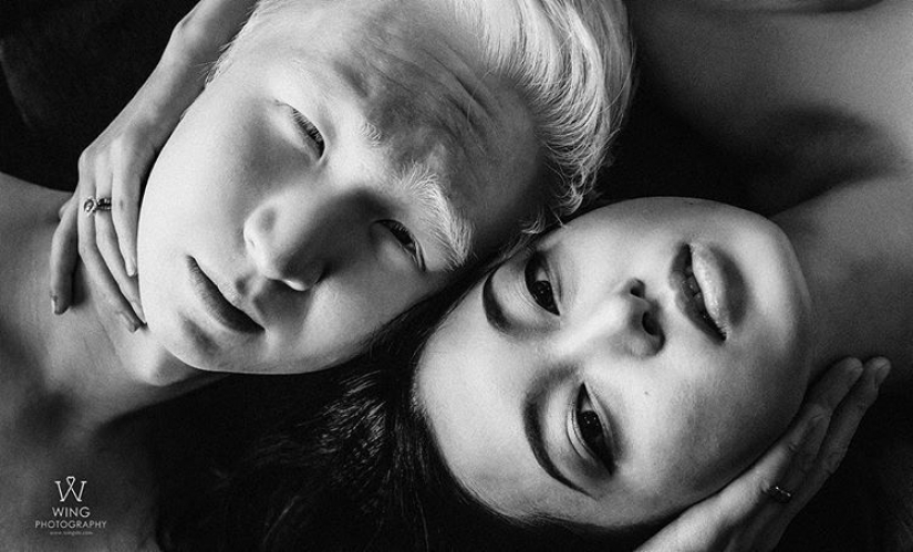 How are albinos different nationalities and races How are albinos different nationalities and races