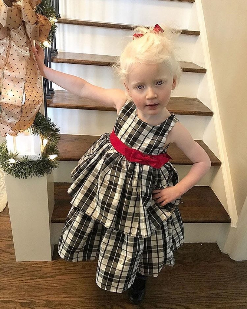 How are albinos different nationalities and races How are albinos different nationalities and races