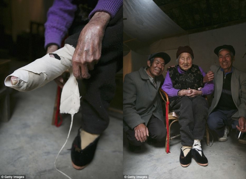 In the village of "bound feet" the last living Chinese women suffering from the ancient brutal tradition