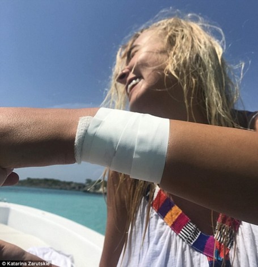 Instagram-the model climbed in the pool with the sharks for the sake of likes and almost lost my hand