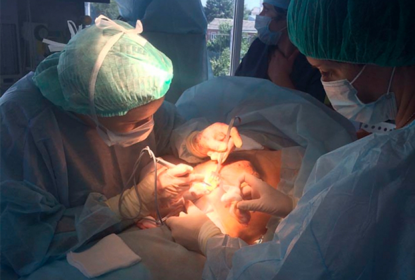 Krasnodar "Dr. Frankenstein," conducted plastic surgery in the kitchen and in the pantry