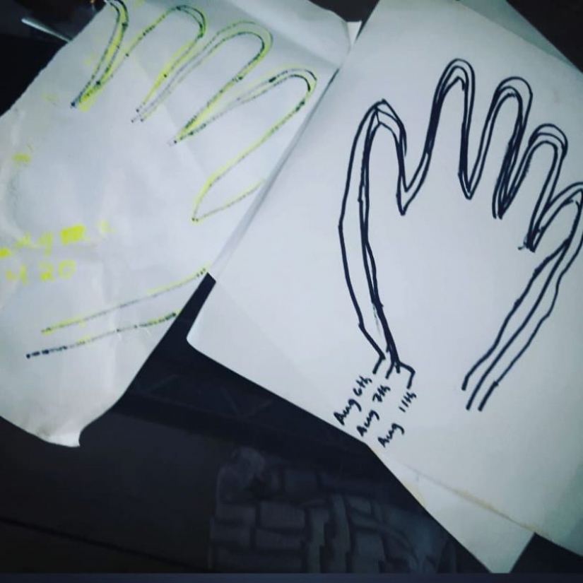 La chica poco a poco se convirtió feo y los médicos durante años no pudo encontrar la causa. Afortunadamente, todo terminó bien La chica poco a poco se convirtió feo y los médicos durante años no pudo encontrar la causa. Afortunadamente, todo terminó bien