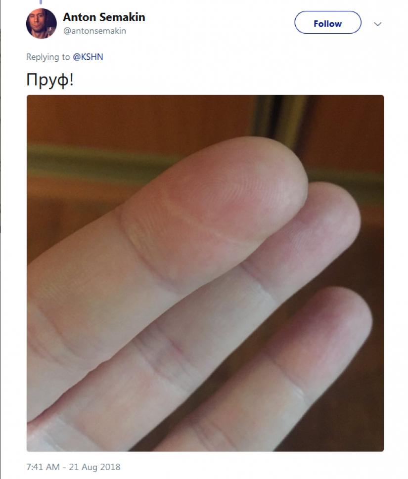 La gente de repente se dio cuenta de que todos ellos tienen una cicatriz en el dedo índice