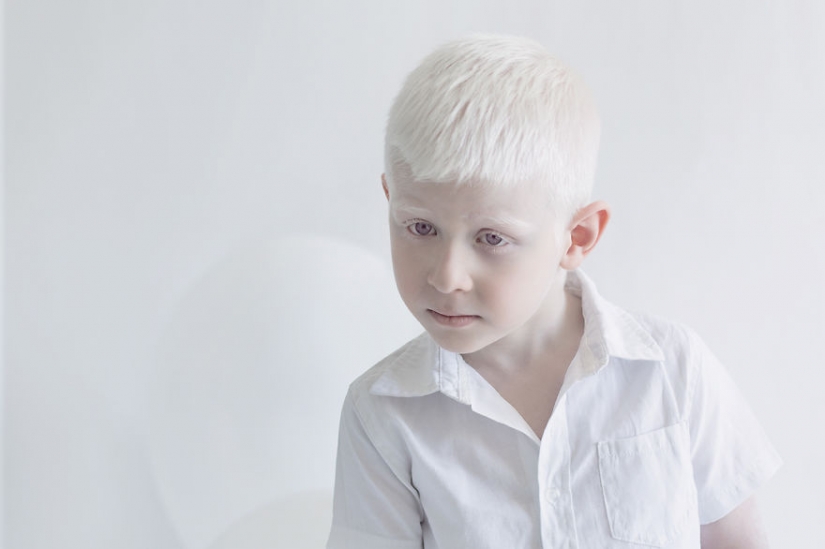 La hipnótica belleza de los albinos en el proyecto de Julia Taits La hipnótica belleza de los albinos en el proyecto de Julia Taits