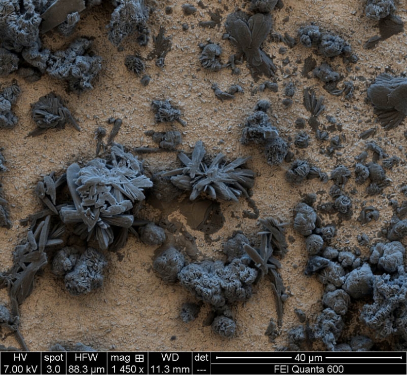 Las fotos tomadas con un microscopio electrónico Las fotos tomadas con un microscopio electrónico