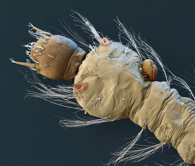 Las fotos tomadas con un microscopio electrónico Las fotos tomadas con un microscopio electrónico