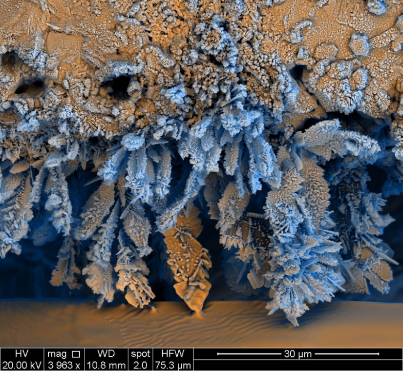 Las fotos tomadas con un microscopio electrónico Las fotos tomadas con un microscopio electrónico