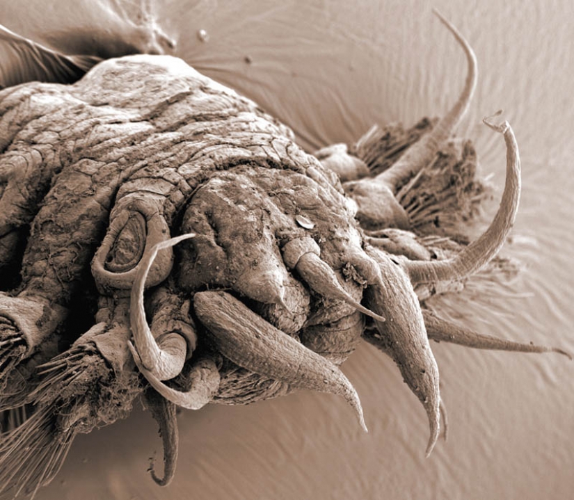 Las fotos tomadas con un microscopio electrónico Las fotos tomadas con un microscopio electrónico