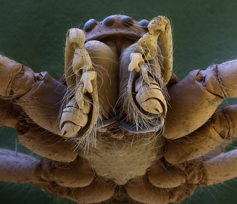 Las fotos tomadas con un microscopio electrónico Las fotos tomadas con un microscopio electrónico