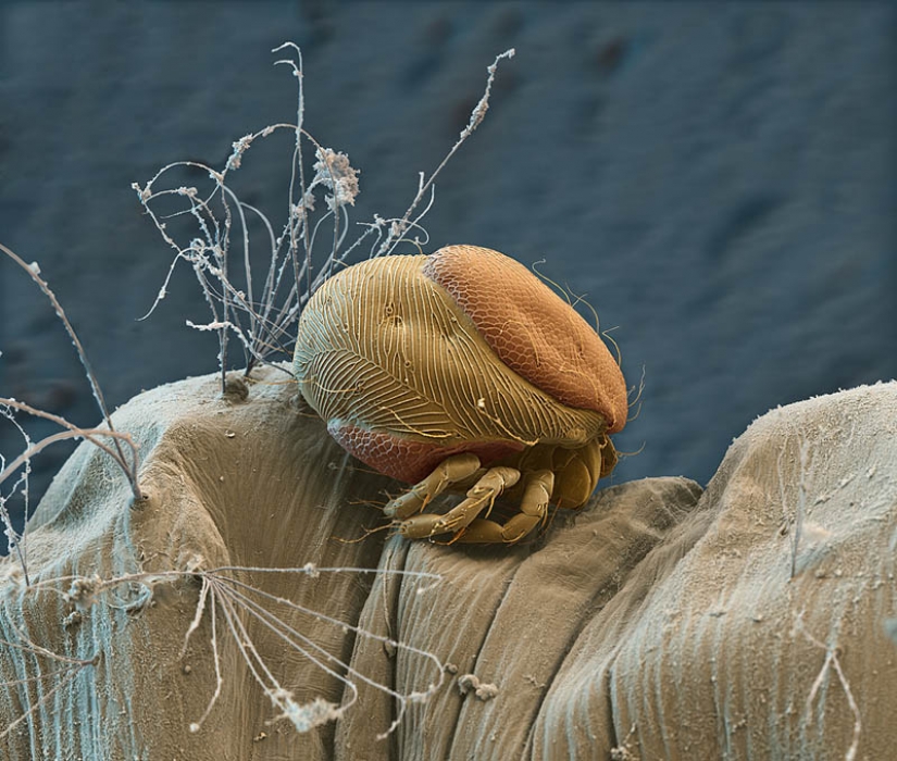 Las fotos tomadas con un microscopio electrónico Las fotos tomadas con un microscopio electrónico