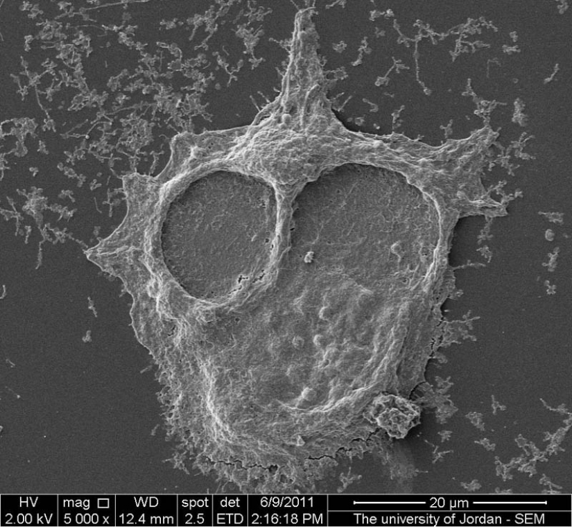 Las fotos tomadas con un microscopio electrónico Las fotos tomadas con un microscopio electrónico