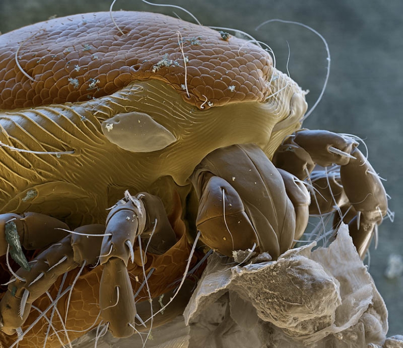 Las fotos tomadas con un microscopio electrónico Las fotos tomadas con un microscopio electrónico