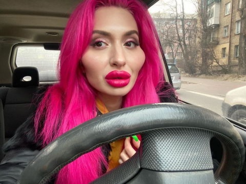 Las mejillas de barriles: de Kiev en sí inyecta rellenos para ser especial