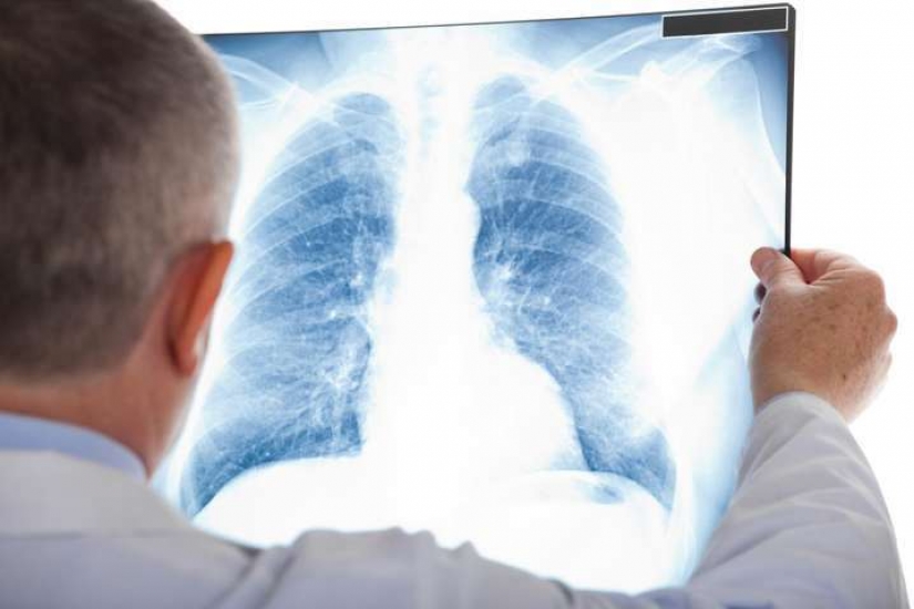Lo que hemos descubierto después de la autopsia de los cadáveres de las víctimas de coronavirus