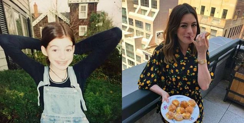 Looked like 20 celebrities before they have learned millions