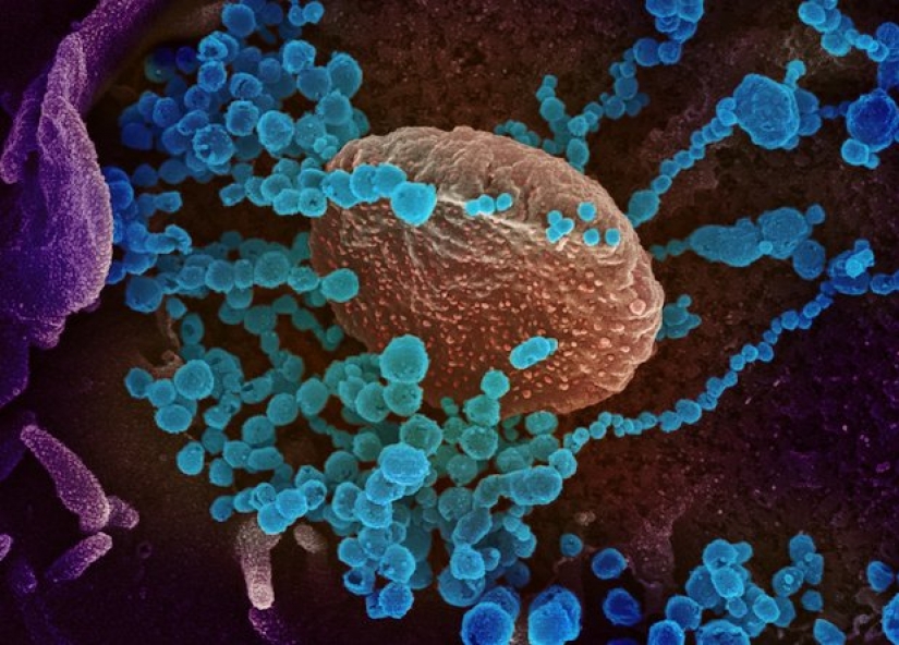 Los científicos creen que para ganar el coronavirus ayudará a Lama