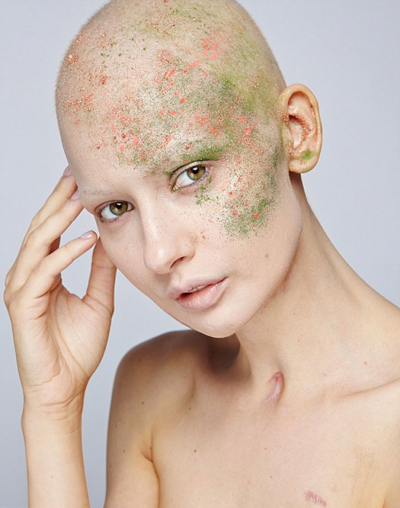 Los doctores le dijeron que el modelo tiene un aborto después de que se ha eliminado el 95% de la mandíbula para el cáncer — y eso es lo que ella hizo