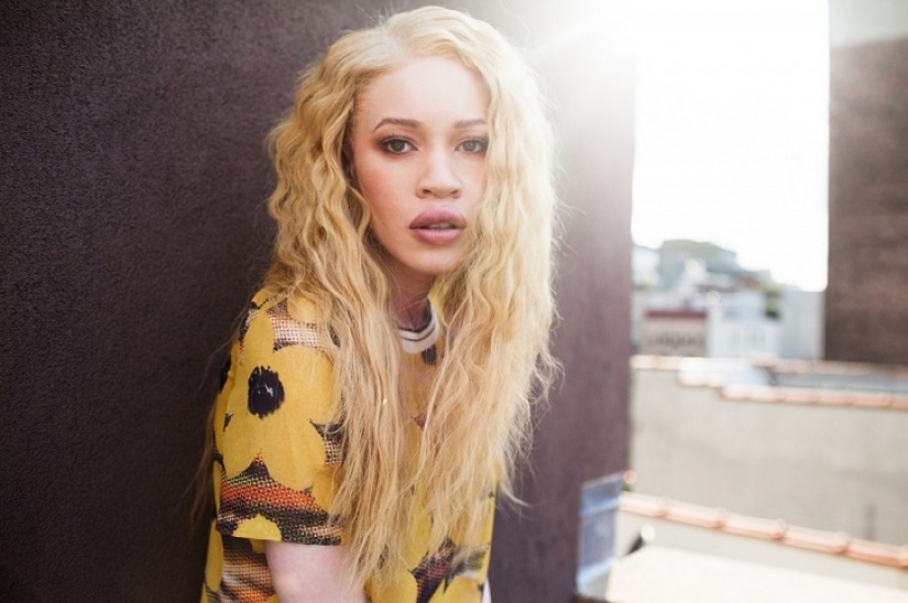 Los modelos que nos inspiran no sólo por su belleza sino también increíble fortaleza