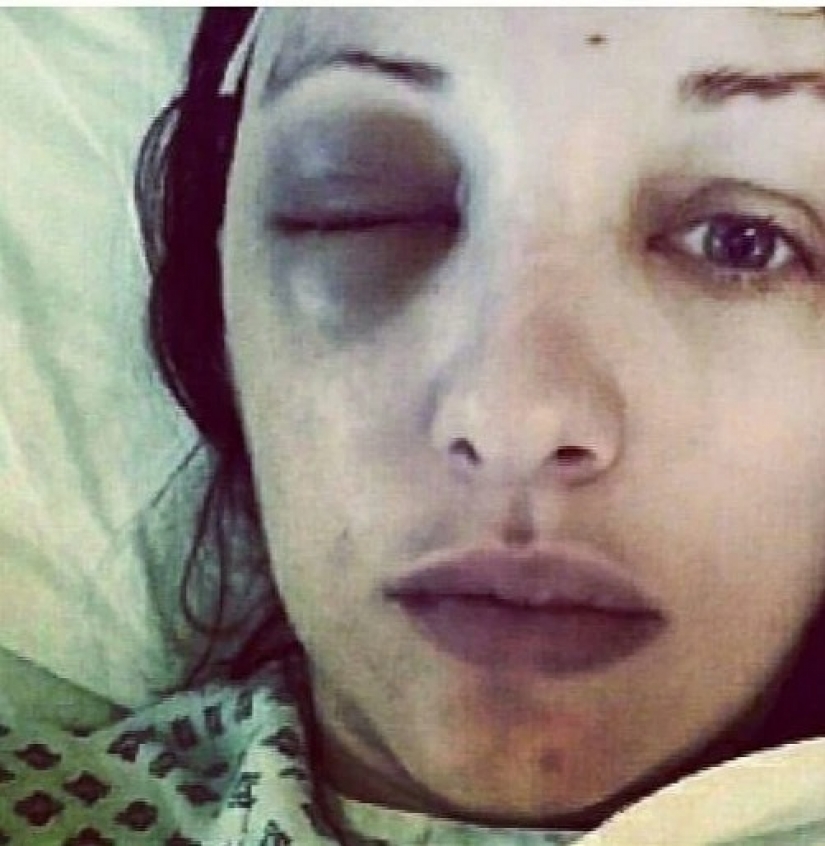 Modelo de Playboy, que permaneció sólo un año, había sido curado de cáncer gracias a la marihuana