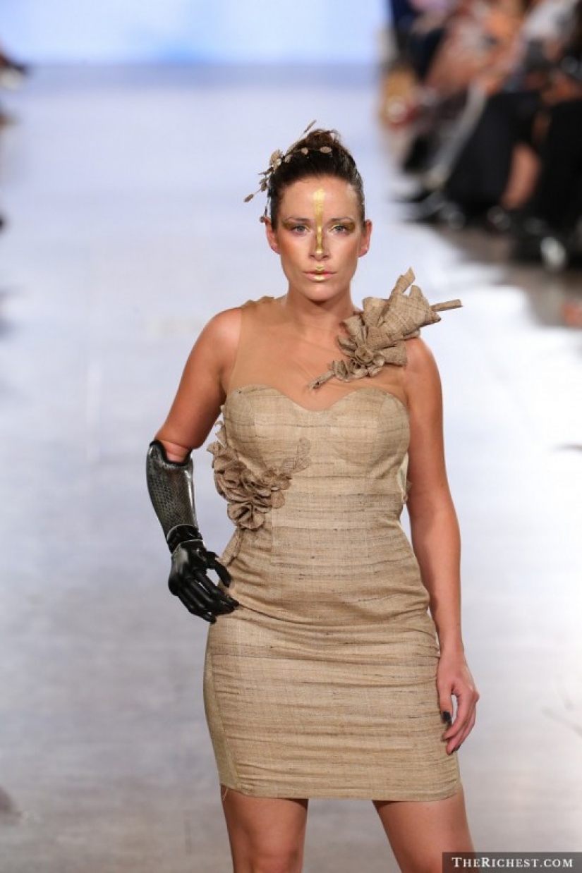 Models that inspire us not only for its beauty but also incredible fortitude