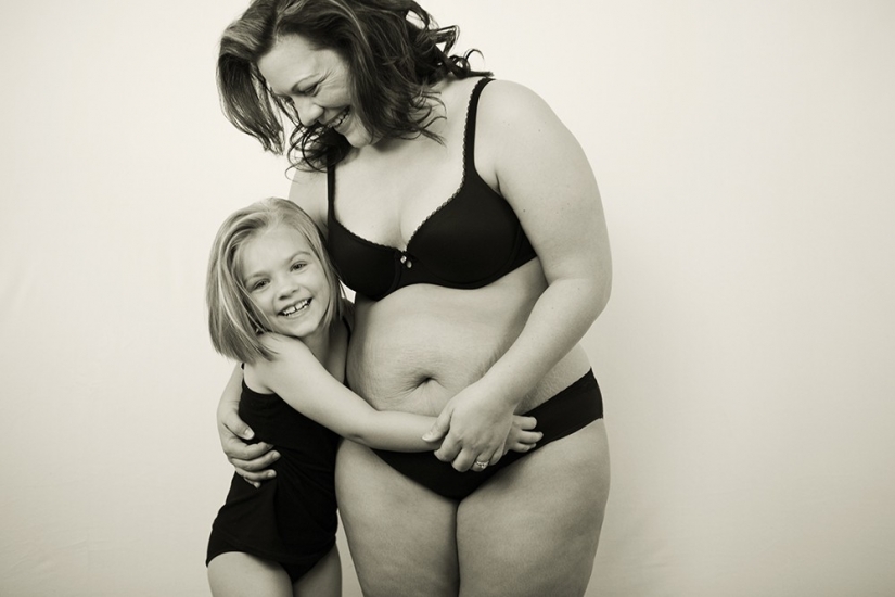 Motherhood more stretch marks and scars: the photocycle of how women fall in love with your body after childbirth