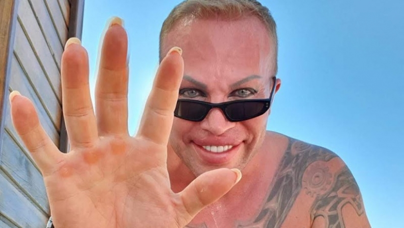 Parecía un famoso culturista-freak Alexander Shpak antes de la reencarnación Parecía un famoso culturista-freak Alexander Shpak antes de la reencarnación