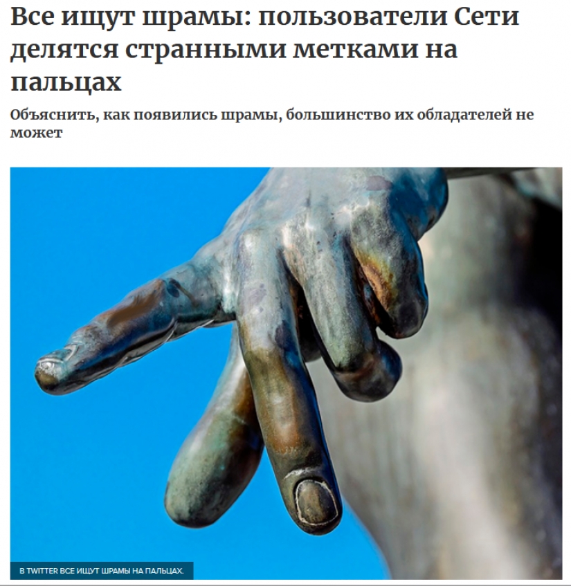 People suddenly realized that all of them have a scar on the index finger