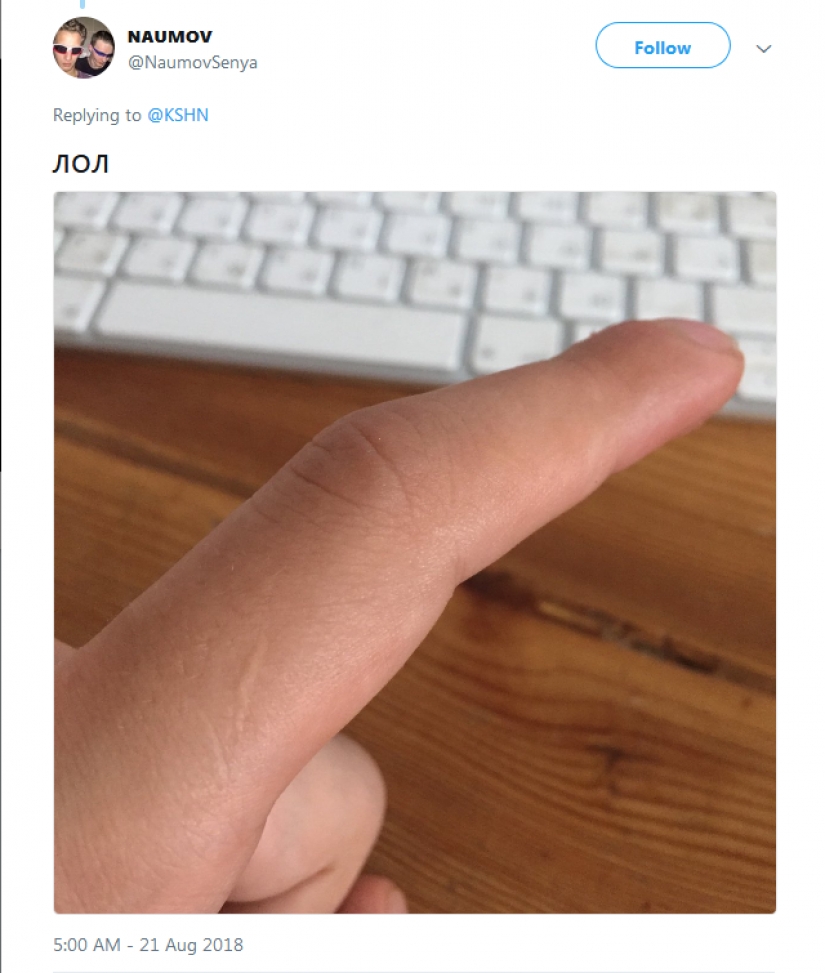 People suddenly realized that all of them have a scar on the index finger