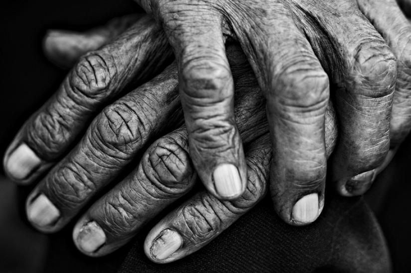 Residents of which countries do not get a pension