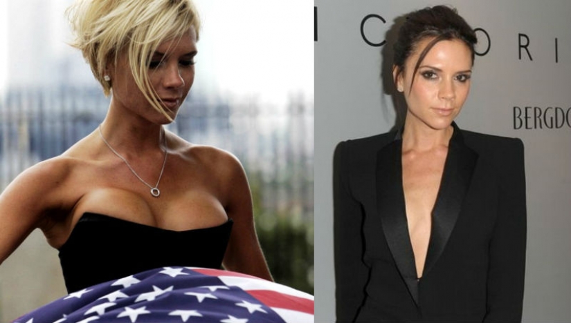 See above: the star, who had surgery for breast reduction See above: the star, who had surgery for breast reduction