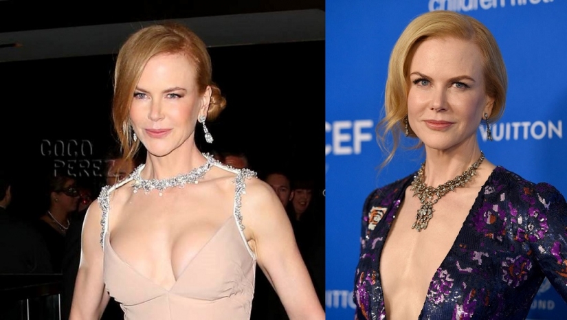 See above: the star, who had surgery for breast reduction See above: the star, who had surgery for breast reduction