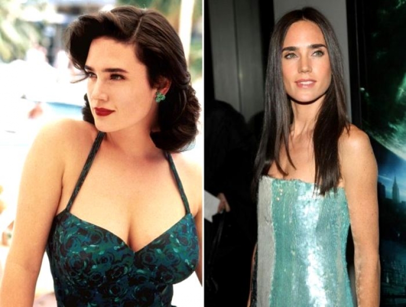 See above: the star, who had surgery for breast reduction See above: the star, who had surgery for breast reduction
