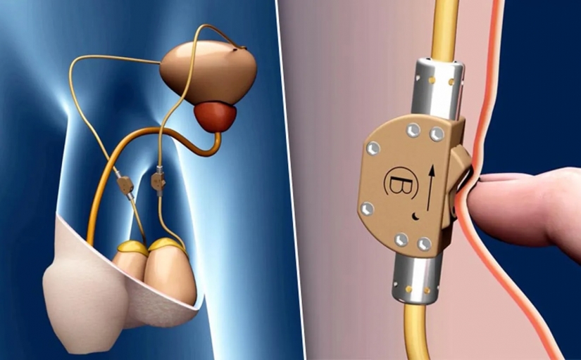 Sex breakthrough: the 5 most incredible scientific achievements of the recent years Sex breakthrough: the 5 most incredible scientific achievements of the recent years