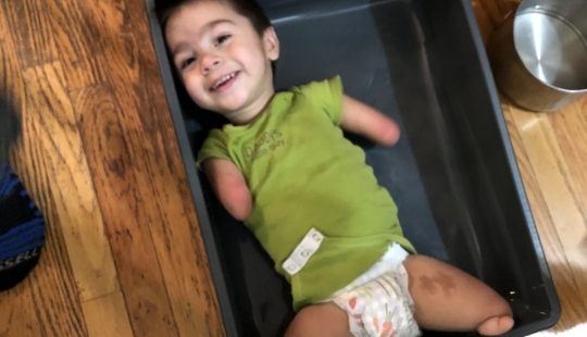 Sin brazos, sin piernas, no hay problema: cumplir los 4 años, Henry Sin brazos, sin piernas, no hay problema: cumplir los 4 años, Henry