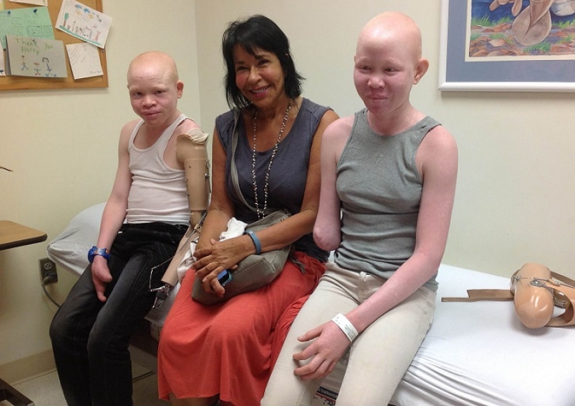 Tanzanian albinos, whose bodies are worth more than gold Tanzanian albinos, whose bodies are worth more than gold