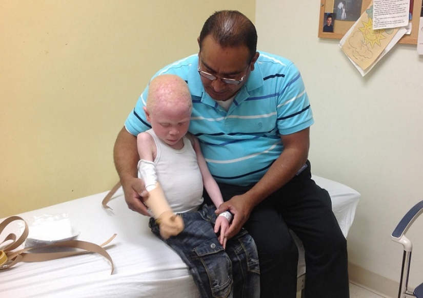 Tanzanian albinos, whose bodies are worth more than gold Tanzanian albinos, whose bodies are worth more than gold