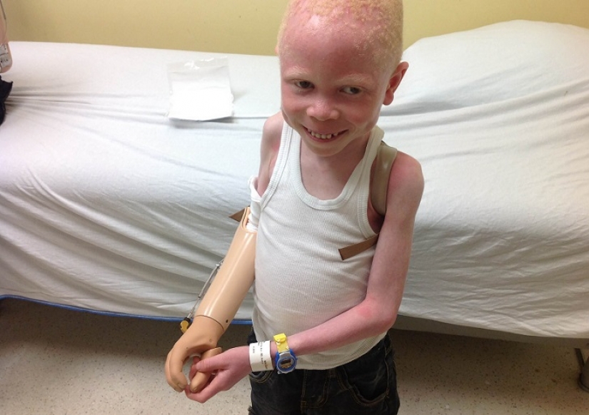 Tanzanian albinos, whose bodies are worth more than gold Tanzanian albinos, whose bodies are worth more than gold