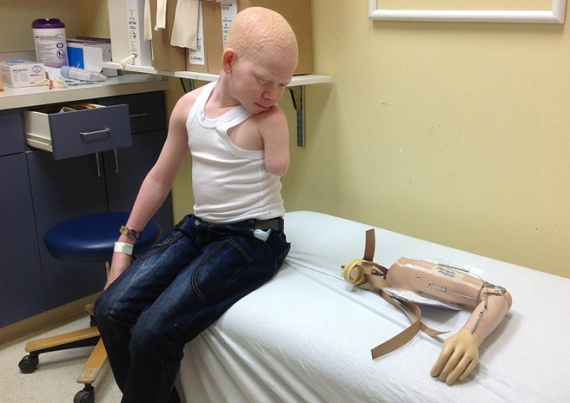 Tanzanian albinos, whose bodies are worth more than gold Tanzanian albinos, whose bodies are worth more than gold