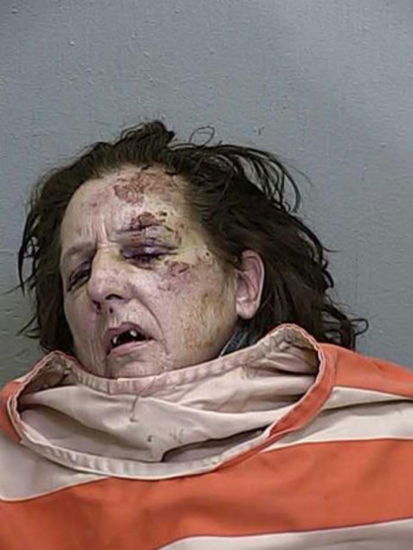 Terrible consequences of the use of methamphetamines