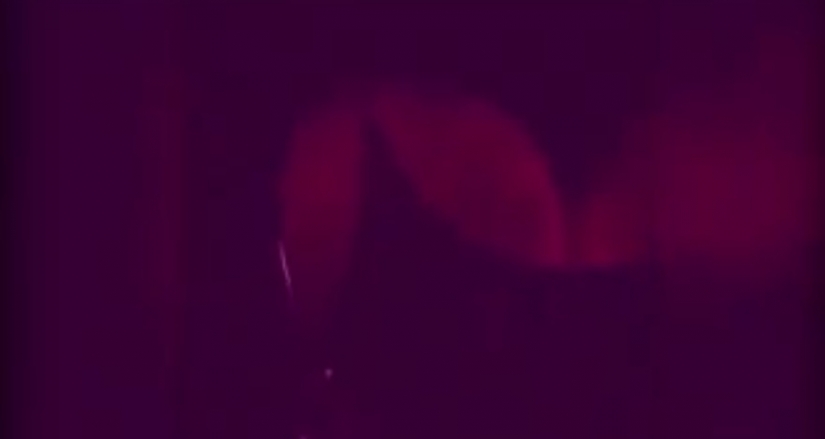 Thai model showed how to detect silicone breast Thai model showed how to detect silicone breast