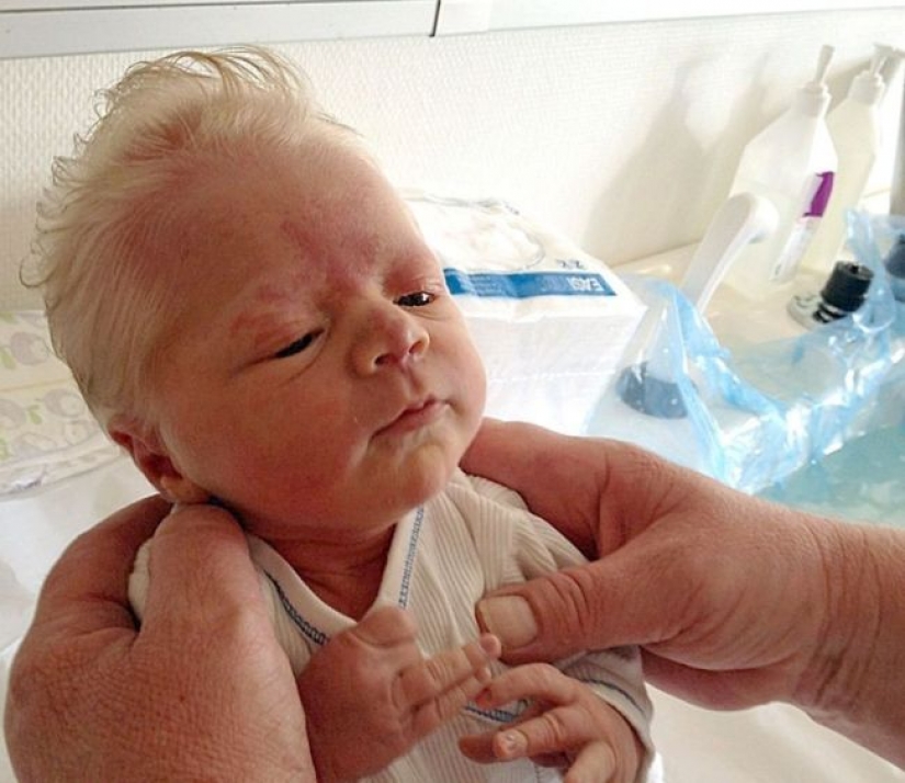The babies look like little old men