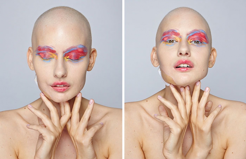 The doctors told the model to have an abortion after she has deleted 95% of the jaw to cancer — and that's what she did The doctors told the model to have an abortion after she has deleted 95% of the jaw to cancer — and that's what she did