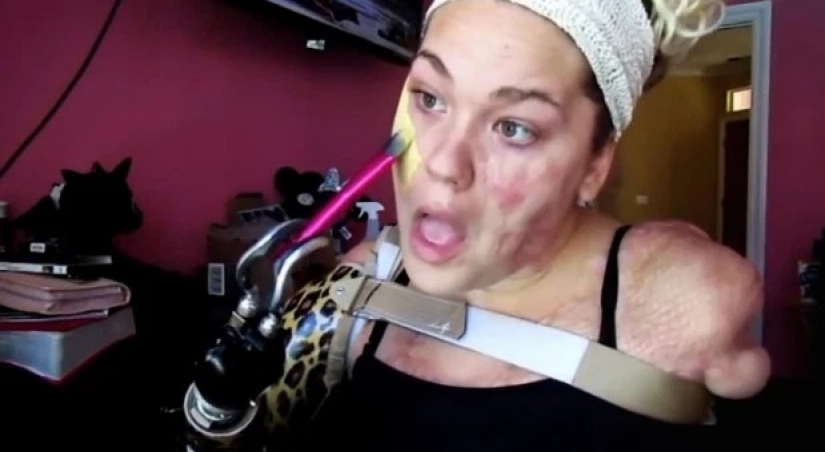 The endless will to live: blogger without arms and legs creates a stunning makeover The endless will to live: blogger without arms and legs creates a stunning makeover