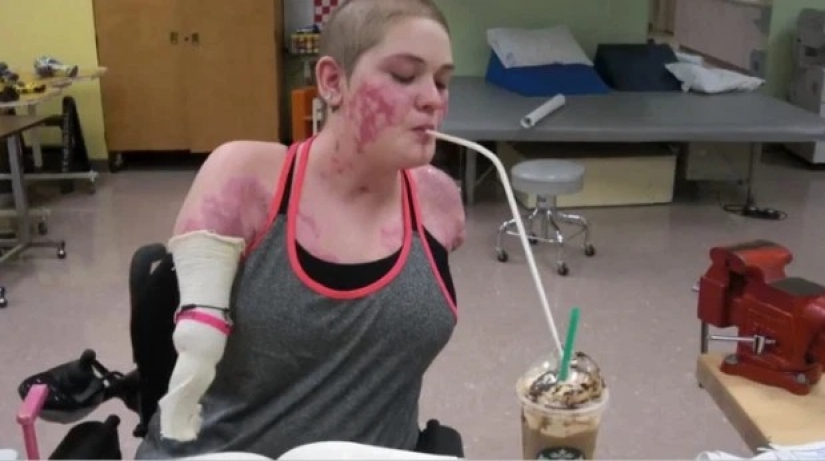 The endless will to live: blogger without arms and legs creates a stunning makeover The endless will to live: blogger without arms and legs creates a stunning makeover