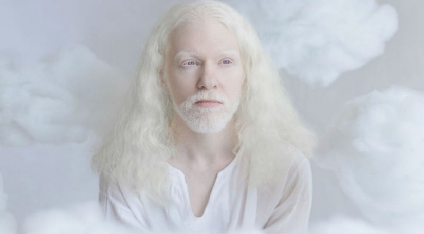 The hypnotic beauty of albinos in the project Julia Taits The hypnotic beauty of albinos in the project Julia Taits