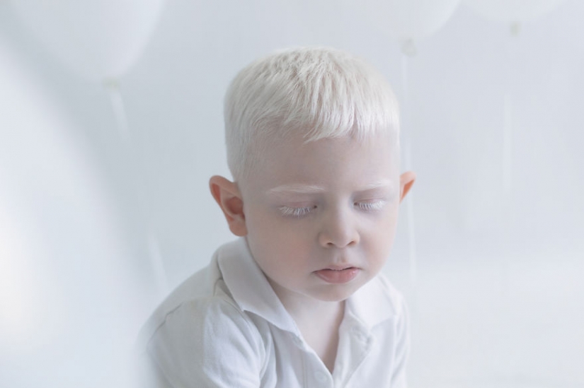 The hypnotic beauty of albinos in the project Julia Taits The hypnotic beauty of albinos in the project Julia Taits