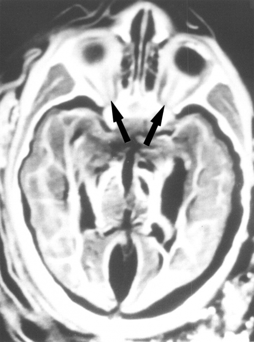 The Inca mummies of sacrificed children and women The Inca mummies of sacrificed children and women